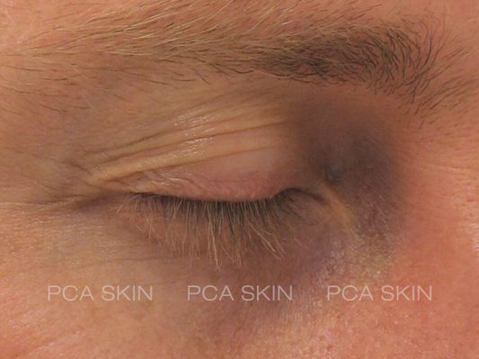 visible-aging-p1-before visible-aging-p1-before